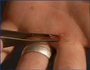 splinter