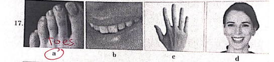 17
